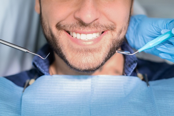 Stop Cavities In Their Tracks With SDF